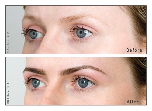 HDBrows Before-After