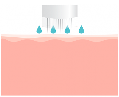 Microneedling